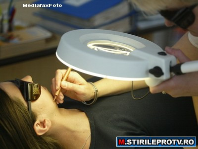 Tratament de infrumusetare de cosmar. Arsa cu laserul pe fata de cosmeticiana