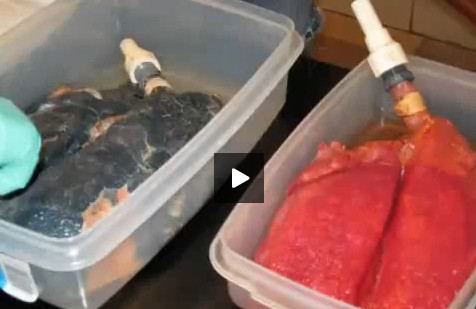 VIDEO. Mai bun decat orice campanie anti-fumat. Clipul care te va face sa renunti la tigari