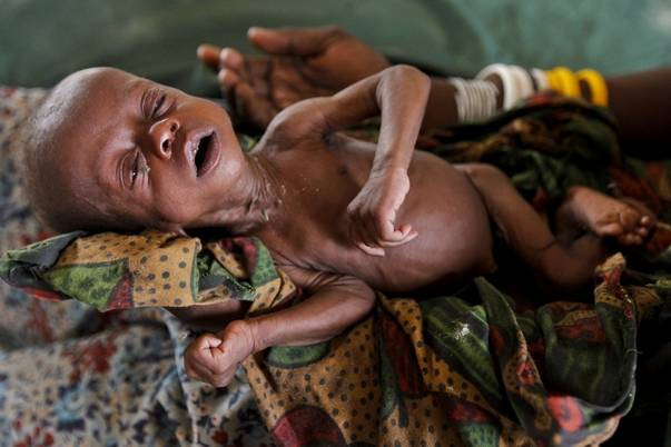 Foto socant. Mamele somaleze trebuie sa aleaga pe care dintre copii sa ii lase sa moara