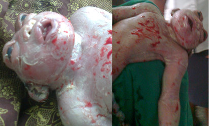 FOTO SOCANT. A crezut ca are gemeni, dar a adus pe lume o creatura ciudata