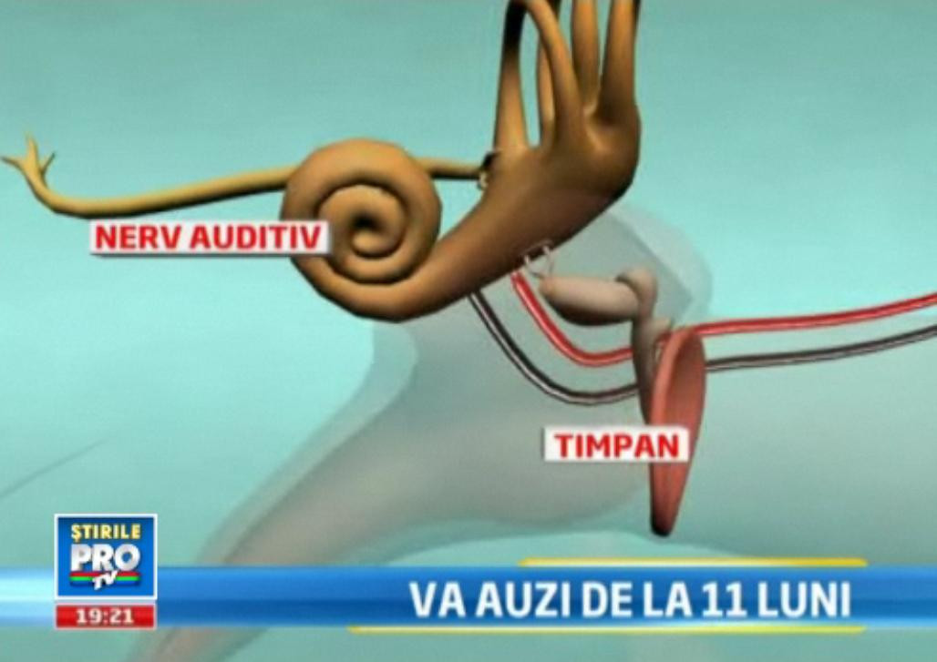 Premiera in Romania. Un bebelus care s-a nascut surd a primit o sansa la o viata normala
