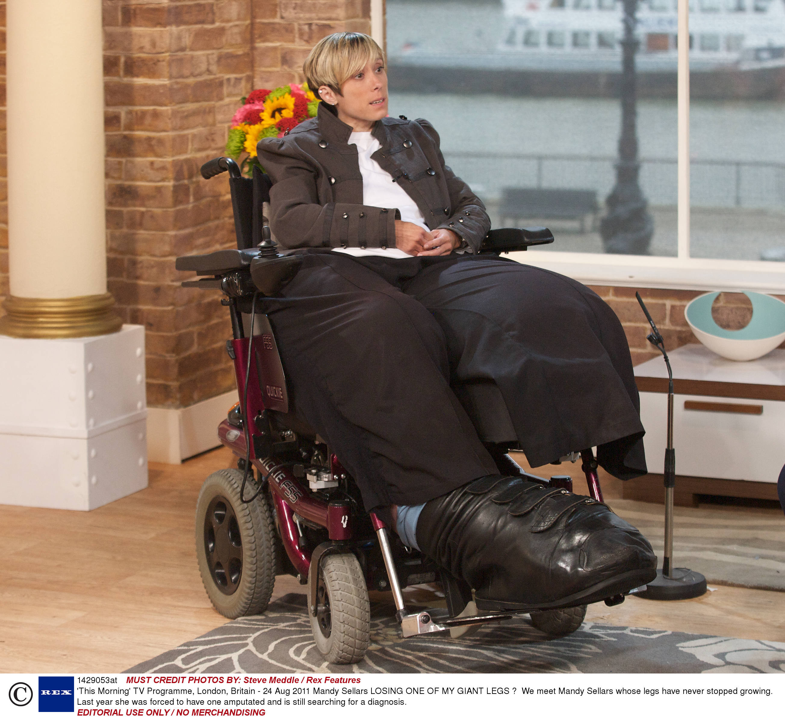 FOTO.E obligata sa traiasca cu cel mai mare picior din lume. Povestea impresionanta a Femeii Elefant