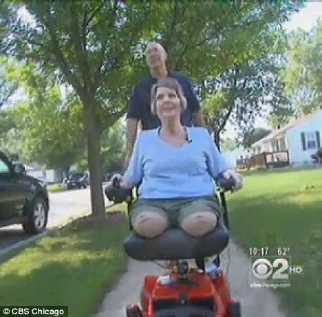 VIDEO. Caz cutremurator in SUA: a vrut sa slabeasca, dar si-a pierdut ambele picioare