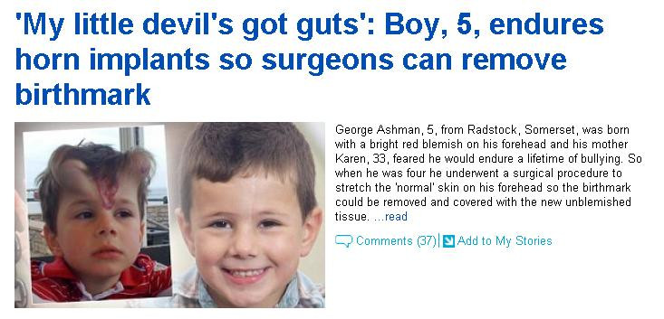 Motivul uimitor pentru care acest copil a ajuns sa arate ca un demon. FOTO