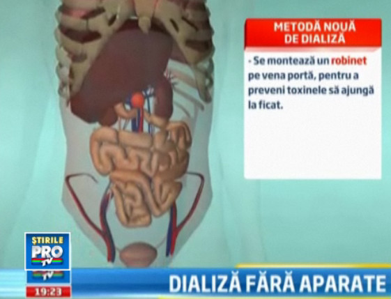 Inventia "made in Romania" care ar putea darama o afacere de 4 ori cat PIB-ul tarii noastre