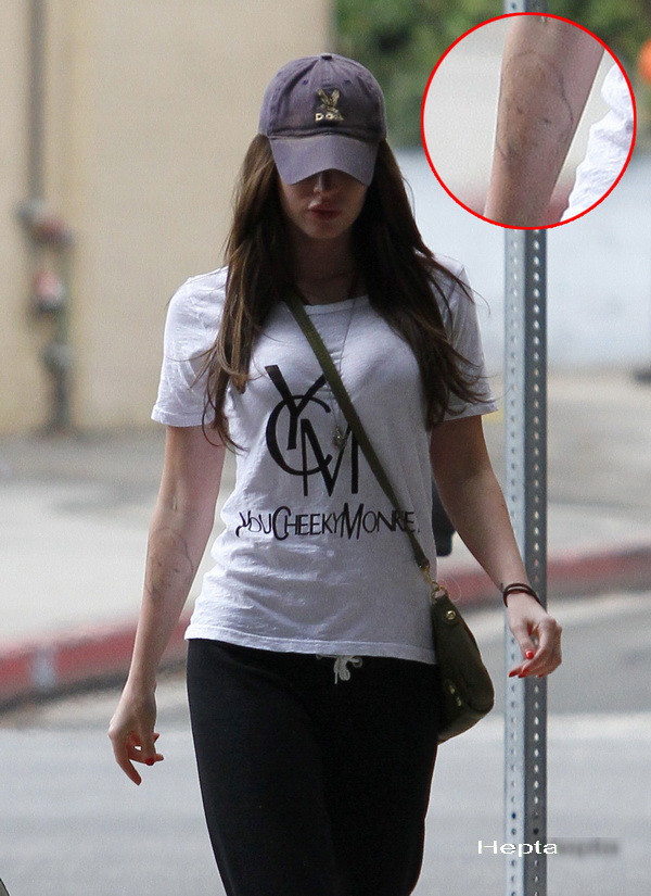 De ce vrea sa scape cu disperare cea mai sexy femeie din lume? Urmeaza chiar un tratament