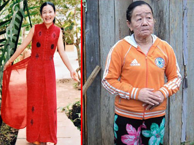 Aceasta batrana are doar 26 de ani. Misterul ei ii nelinisteste pe medici