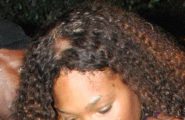 Ce se intampla cu parul Serenei Williams? Jucatoarea de tenis risca sa cheleasca