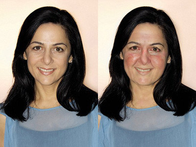 Tutunul dauneaza grav sanatatii, dar si frumusetii. Vezi cum iti va schimba infatisarea