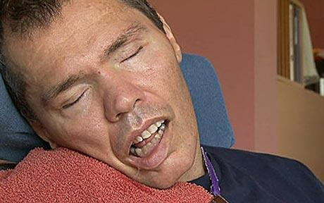 Ce-au aflat rudele despre un barbat pe care toata lumea l-a crezut in coma timp de 25 de ani