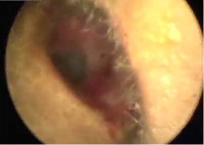 INTERZIS daca nu ai stomacul tare. Nu o sa iti vina sa crezi ce au gasit medicii in capul acestui om