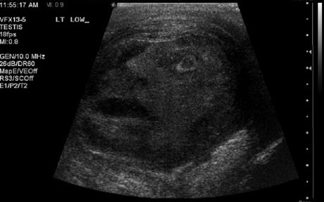 FOTO. Medicii au ramas socati. N-o sa-ti vina sa crezi unde au gasit acest chip uman