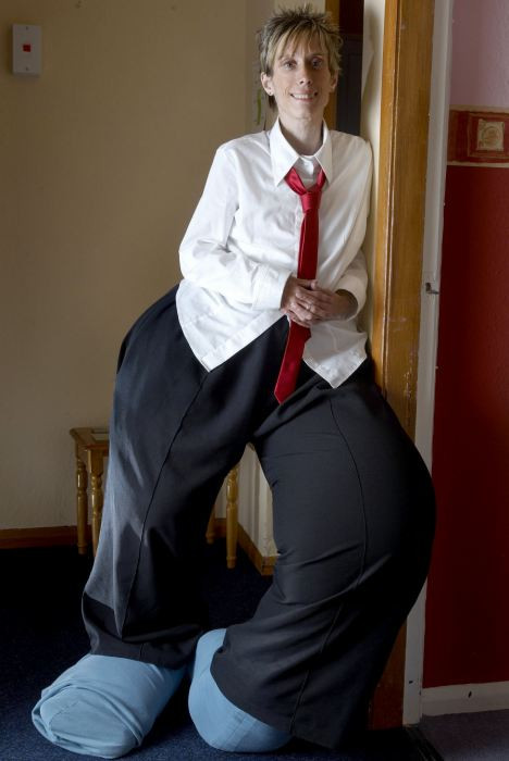 Piciorul amputat a inceput sa creasca din nou. Incredibila boala a lui Mandy Sellar