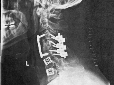 Legatura dintre aceasta imagine si dependenta de medicamente a unei fetite nou-nascute