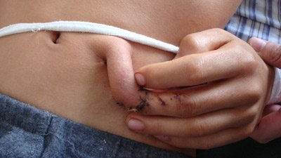 deget in abdomen