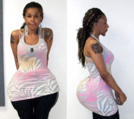 Prima victima a "medicului" care face "posteriorul beton". Mai multe femei sunt in pericol de moarte