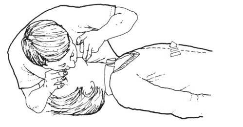 lectia de prim ajutor 3