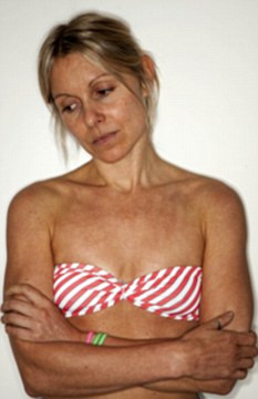 "M-am uitat in oglinda si am inceput sa urlu". Cum a ajuns sa arate asa. GALERIE FOTO