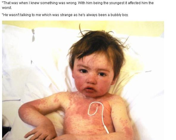 A avut 12 operatii pe creier si este al patrulea om din lume care a invins o bacterie mutant, fatala