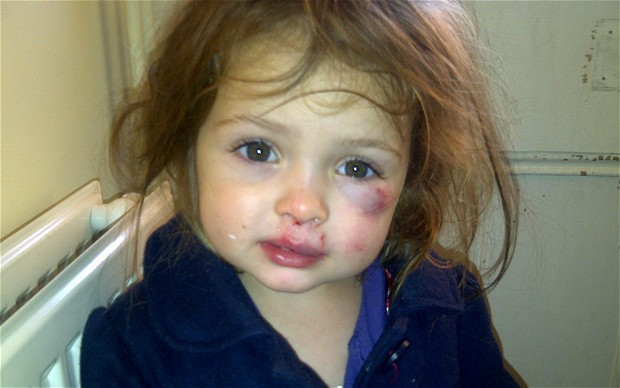 Invinetita si plina de sange. Nici prin gand nu-ti trece cine a batut-o pe fetita de 3 ani