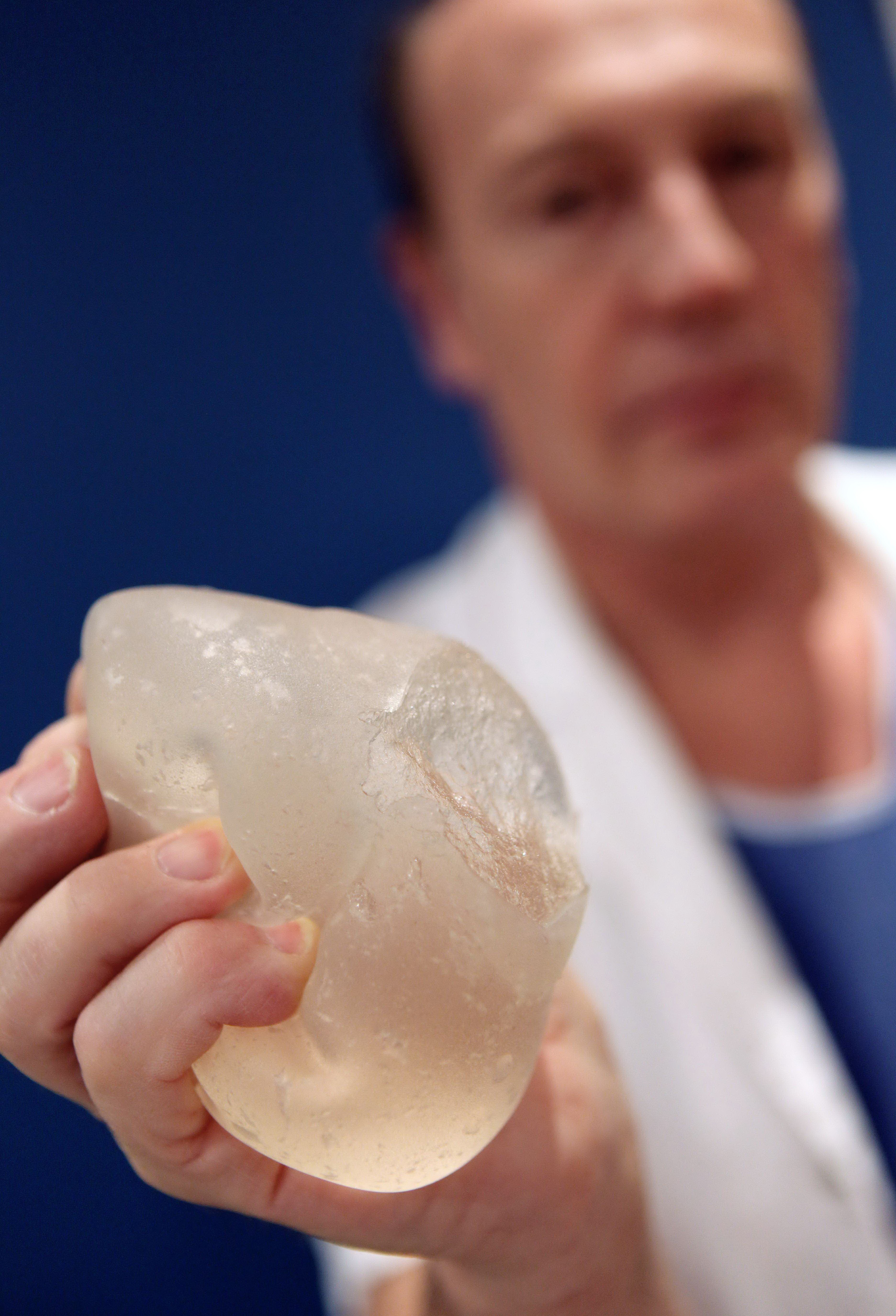 Alerta mondiala in scandalul implanturilor cu silicon din Franta. Sute de mii de femei, in pericol