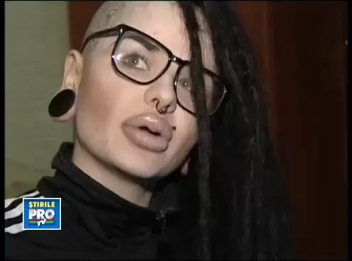 VIDEO. Femeia cu cele mai mari buze. A cheltuit 6.000 de dolari ca sa semene cu un personaj animat