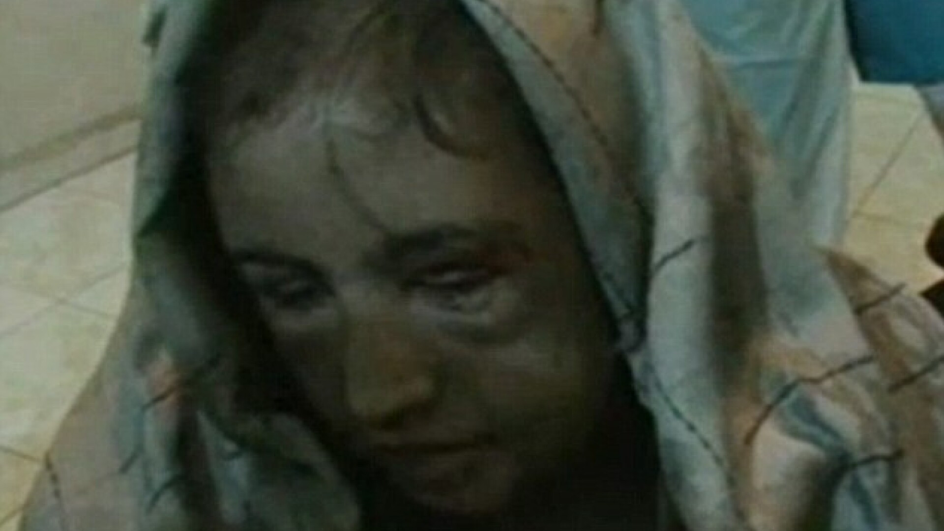 I-au smuls pielea cu clestele.”Este unul dintre cele mai grave cazuri de violenta impotriva femeii”