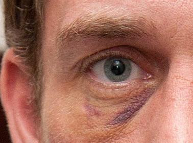 “M-a snopit in bataie. Am ajuns la urgenta”. Declaratia socanta a iubitului unei artiste celebre