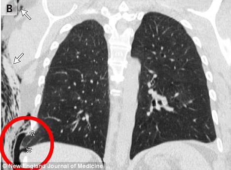 A ajuns la spital in chinuri groaznice dupa un gest banal pe care il faci si tu macar o data pe zi