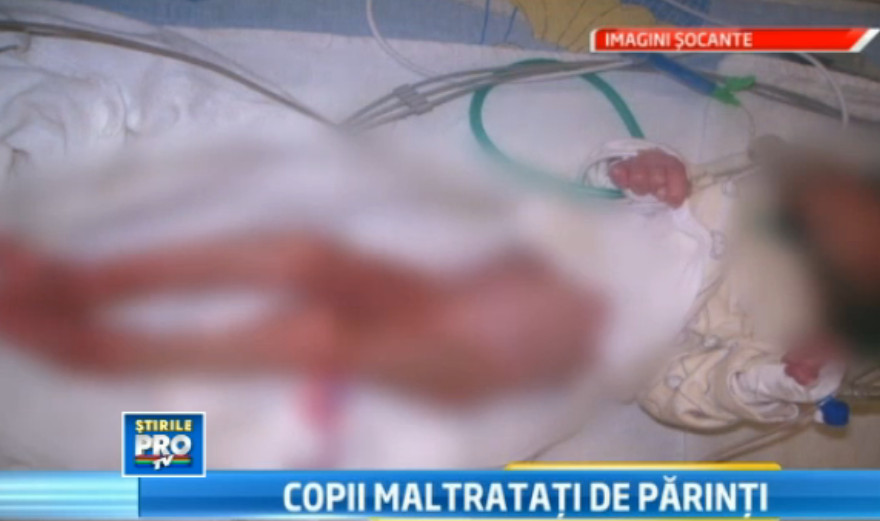 Pacat de moarte. Abia au venit pe lume si arata ca de 80 de ani.Doi bebelusi, neingrijiti de parinti