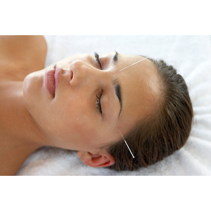 Tinerete vesnica fara bisturiu. Chirurgia estetica pierde teren in fata acupuncturii