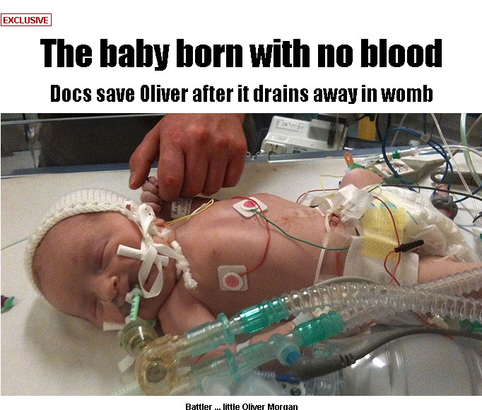 Copilul care ar fi trebuit sa moara la nastere. A venit pe lume fara un element indispensabil vietii