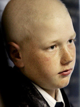 Un baiat care a invins cancerul a fost exmatriculat pentru un gest emotionant