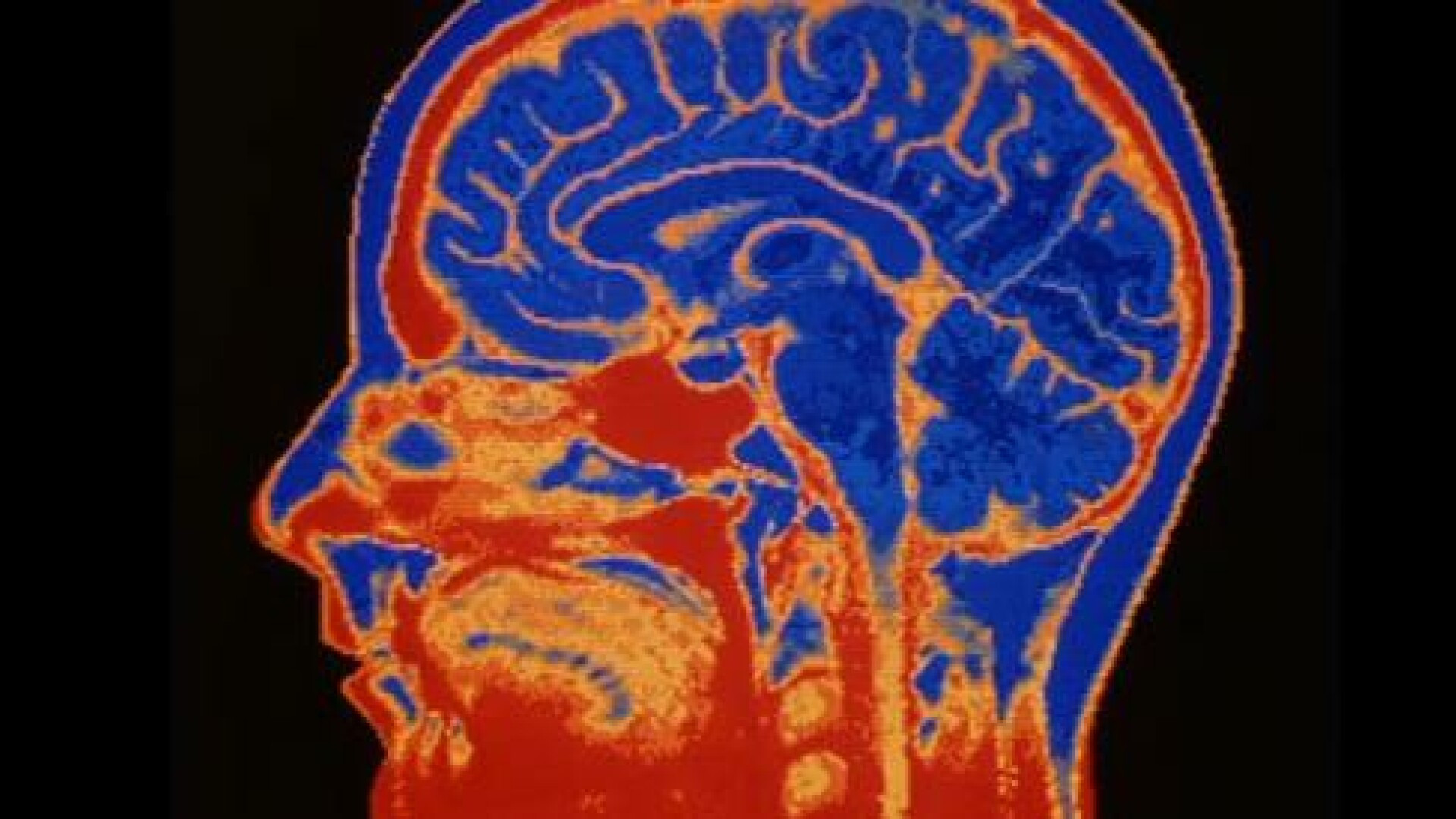 "Punctul lui Dumnezeu", descoperit. Care sunt zonele din creier responsabile cu spiritualitatea