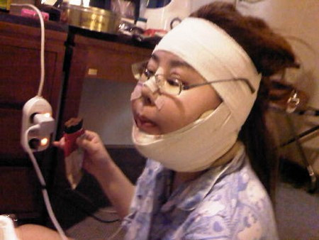 Operatiile de 136.000 prin care a trecut pentru a semana cu un personaj de desene animate. FOTO