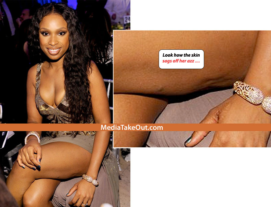 Parti din corpul ei au un aspect greu de privit. Ce se intampla cu pielea unei talentate actrite