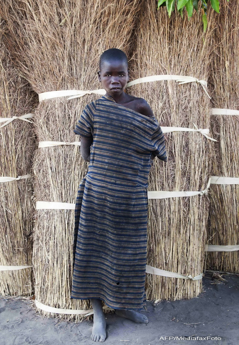 copii bolnavi, Uganda