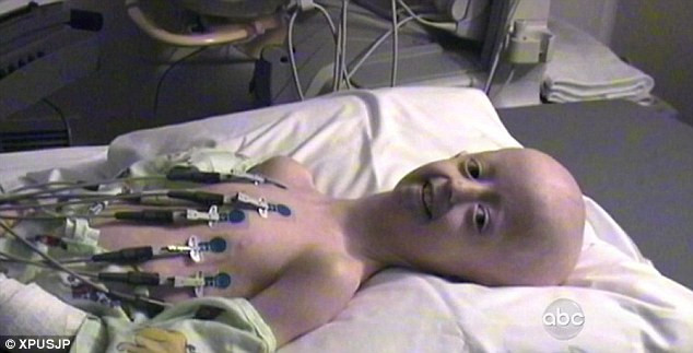 Povestea de "una la opt milioane" a unei fete de 14 ani care arata de 104. Medicii sunt depasiti