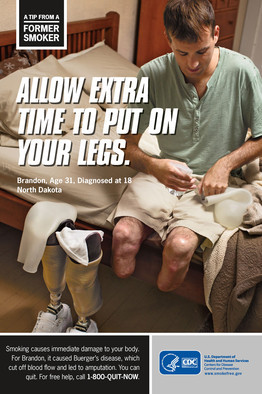 FOTO si VIDEO. Campanie anti-fumat SOCANTA, insa de data aceasta pozele sunt REALE