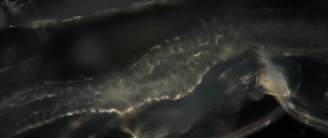 VIDEO. Ce se ascunde intr-o picatura de apa. Imagini incredibile cu o lume invizibila pana acum