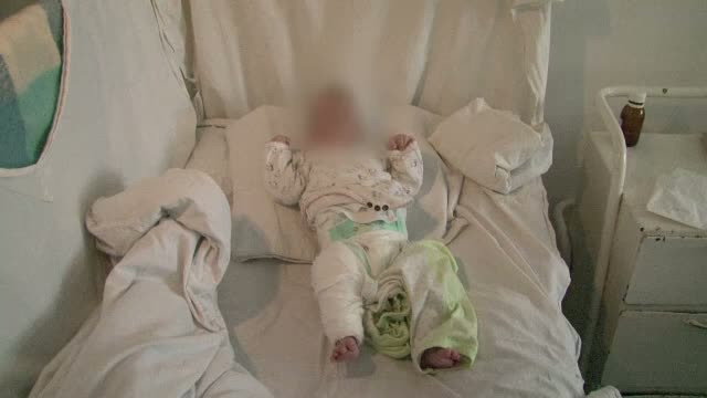 Batuta crunt de propria mama. O fetita de numai patru luni a trecut prin chinuri greu de suportat
