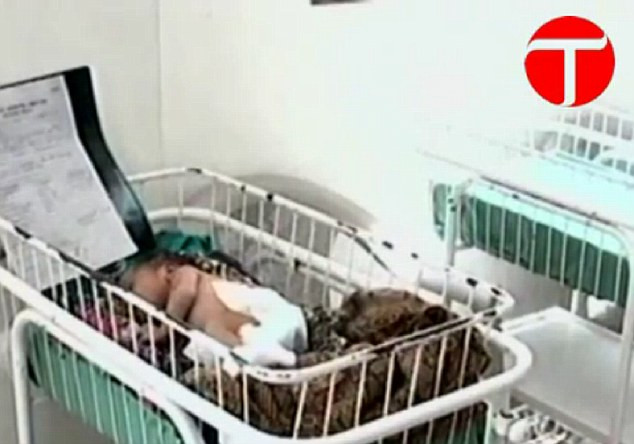 O fetita din Pakistan s-a nascut cu trei maini, din cauza unei afectiuni rare. IMAGINI NECENZURATE