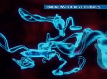 O descoperire a medicilor romani ofera o sansa bolnavilor care sufera accidente vasculare cerebrale