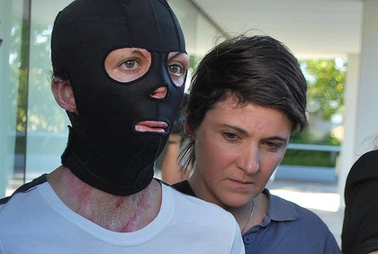 Drama incredibila ascunsa de masca. "Eram fotomodel. Nu mi-au spus la ce risc ma expun"