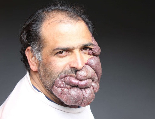 “Nici nu am incercat vreodata sa-mi gasesc o sotie”. Blestemul care l-a izolat de restul lumii