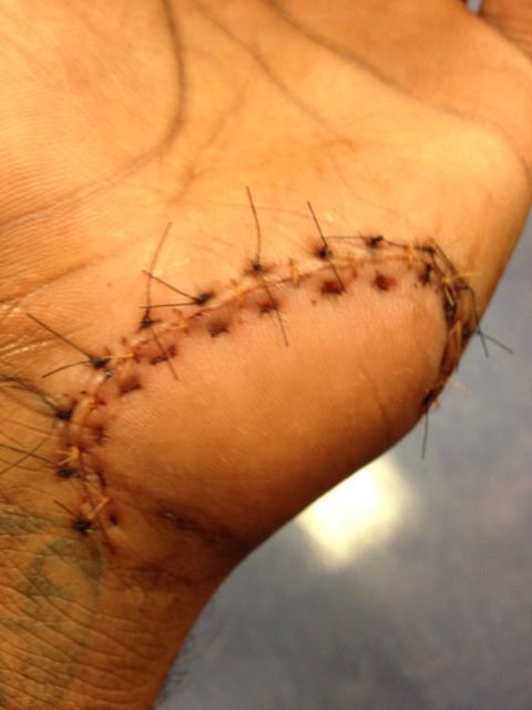 Un jucator din NBA era sa-si piarda mana. Si-a varsat nervii pe un panou pe care-l credea de plastic