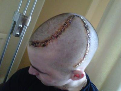 Adevaratul "Nemuritor": A continuat sa traga in talibani chiar si dupa ce a fost impuscat in cap