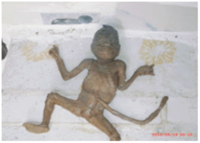 "Am nascut un monstru". Creatura care a iesit din pantecele unei femei dupa 12 luni de sarcina