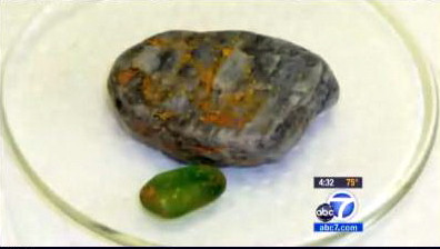 Caz ciudat in SUA. O femeie a suferit arsuri de gradul 3 din cauza unor pietre care au luat foc