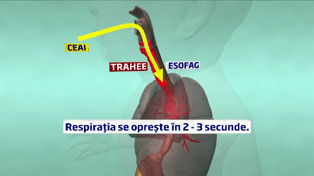 Greseala unei bone si un ceai banal au costat-o viata pe nepoata unui celebru neurochirurg roman